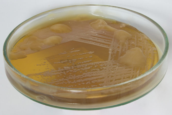 Microbiología aplicada a los procesos productivos en la agroindustria sucroalcoholera: Producción de azúcar, 8-jul-2020